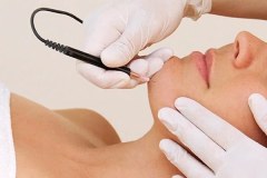 Electrolysis Hair Removal (15 min) | 15 min - Waxing