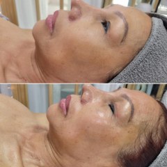 Express Facial | 30 min - Skincare