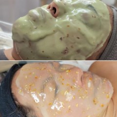 Chemical Peel Treatment | 45 min - Skincare