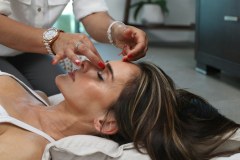 FOLLOW UP Acupuncture Session - Self Pay - Acupuncture