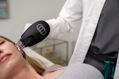 SPE-Botox Consultation | 30 min - Medical Spa