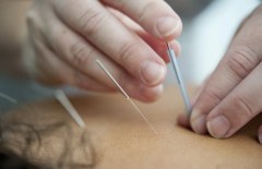 Acne Advanced Facial - Acupuncture