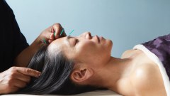 Acupuncture-Facial Rejuvenation - Holistic Wellness