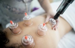 Reiki Add On - Acupuncture - Arvada - Colorado